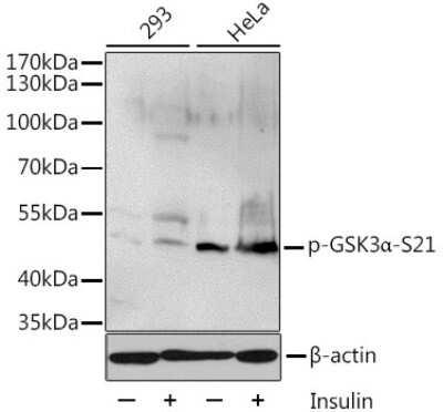 Western Blot: GSK-3 alpha/beta [p Ser21] AntibodyAzide and BSA Free [NBP3-05443]